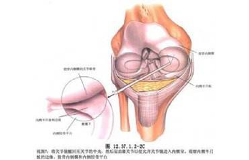 運動醫(yī)學(xué)（關(guān)節(jié)鏡）?？? title=